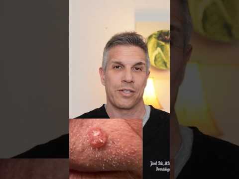 Derm skin cancer ultimate tips😱 [Video]