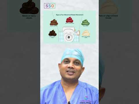 Pancreatic Cancer Symptoms: Understanding Back Pain and More | Dr Nilesh Chordiya [Video]