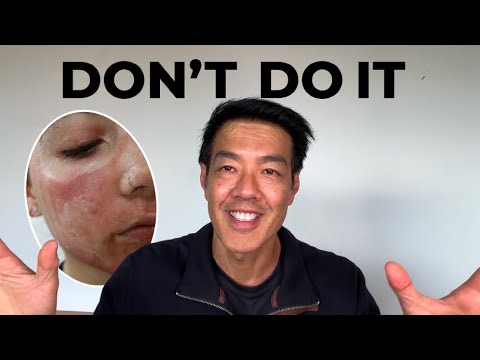 Can CO2 Laser help with Melasma? | Dr Davin Lim [Video]