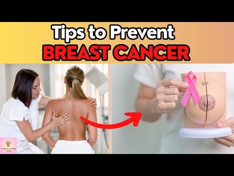 Tips to Prevent Breast Cancer | Early Prevention [Video]
