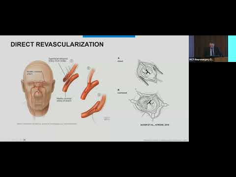 Lecture Series – Lorenzo Rinaldo MD PhD ( 10-30-2023) [Video]