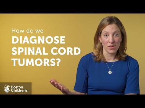 How do we diagnose spinal cord tumors? | Boston Children’s Hospital [Video]