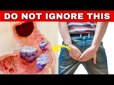 7 Early Signs of Colon Cancer that YOU should Never Ignore [Video]