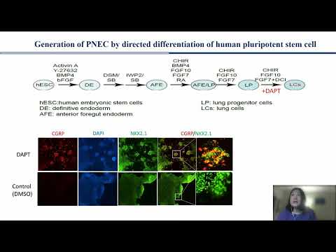 A Stem Cell based Approach to Lung Cancer [Video]