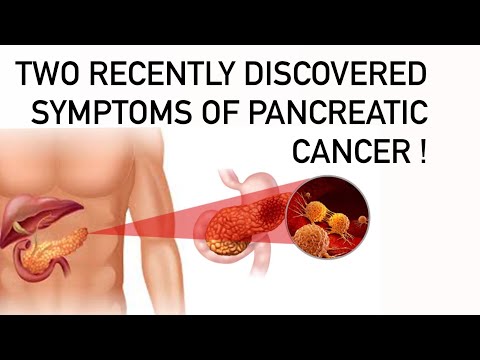 Two recently discovered symptoms of pancreatic cancer. They can appear even a year before others. [Video]