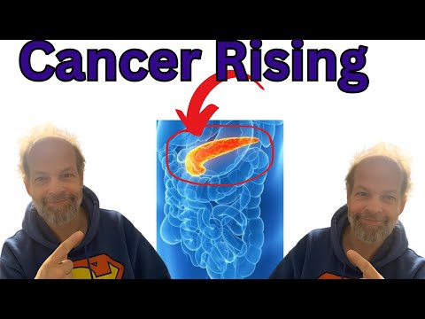 Pancreatic Cancer on the Rise [Video]