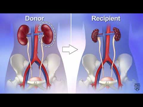 Mayo Clinic Minute: Reasons to be a living kidney donor [Video]