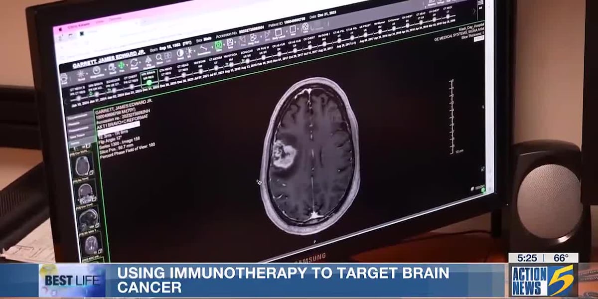 Best Life: Immunotherapy targets brain cancer [Video]