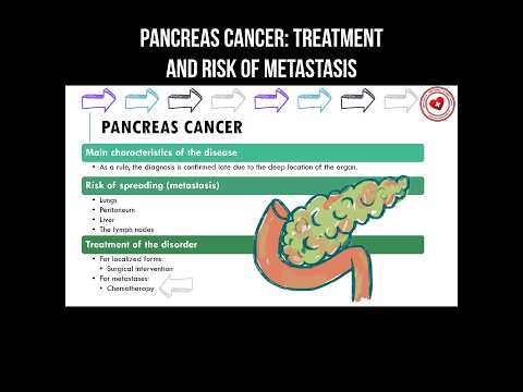 Pancreatic cancer: treatment and risk of metastasis [Video]
