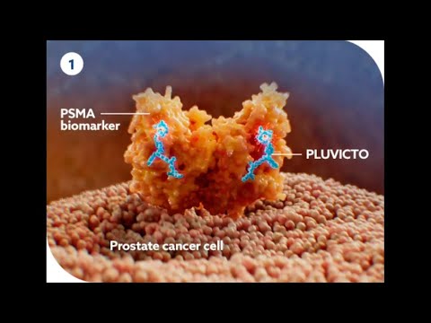 PSA test can help in early detection of prostate cancer [Video]