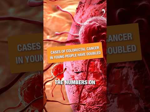 Cases Of Colorectal Cancer in Young people have doubled [Video]