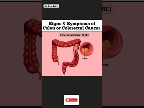 Colon Cancer Symptoms [Video]