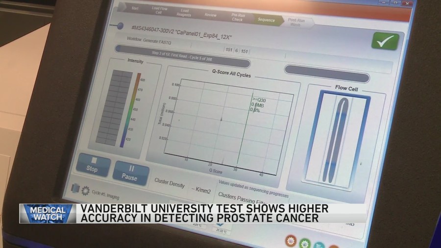 Vanderbilt University test shows high accuracy in detecting prostate cancer  and more [Video]