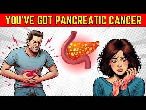 10 Symptoms of PANCREATIC CANCER That Will SHOCK YOU !! [Video]