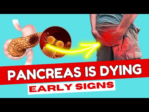 8 Critical Pancreatic Cancer Symptoms You Should Never Ignore! [Video]