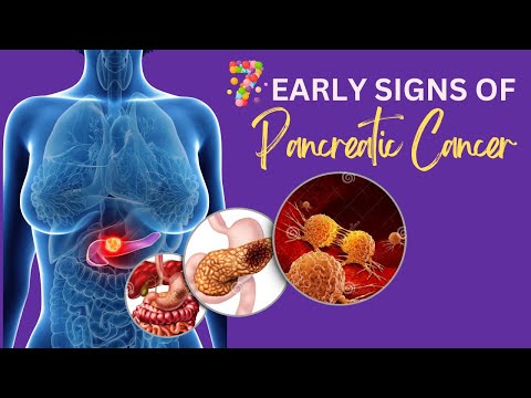 7 Early Warning Signs Of Pancreatic Cancer You Should Know [Video]