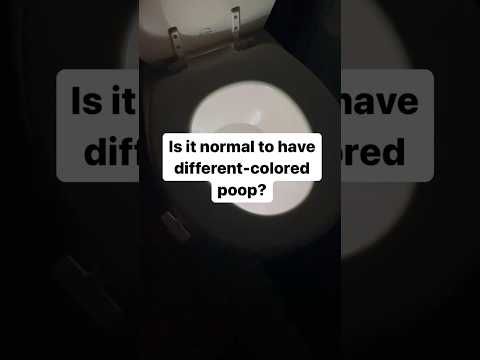 Is it normal to have different-colored poop?💩 [Video]