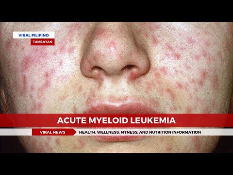 Acute Myeloid Leukemia [Video]