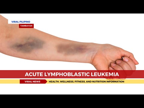 Acute Lymphoblastic Leukemia [Video]