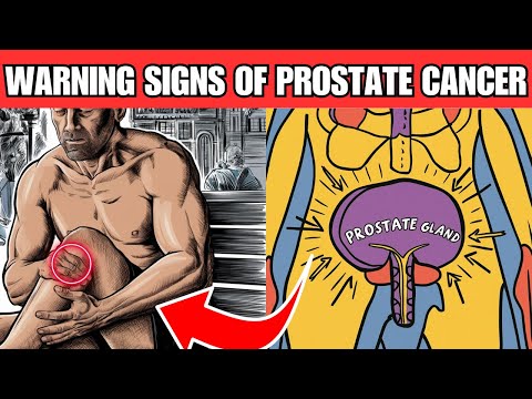 Must Watch! 10 Warning Signs of Prostate Cancer (What Every Man Must Know!) [Video]