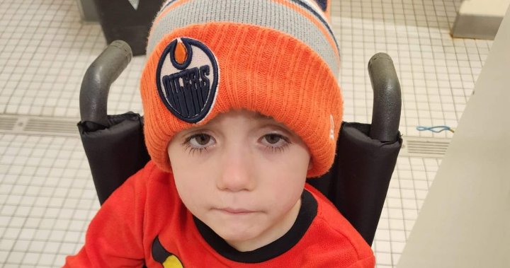 Young Edmonton Oilers fan gives precious heart valve gift [Video]