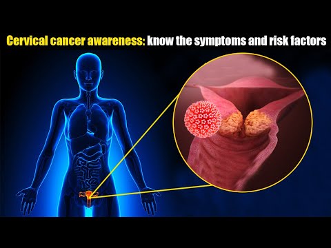Understanding Cervical Cancer: Causes, Symptoms and Prevention [Video]