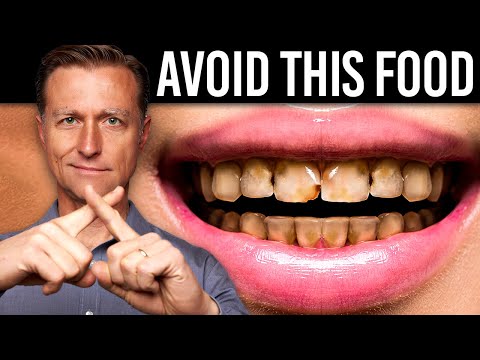 The Worst Food for Your Teeth Is NOT SUGAR [Video]
