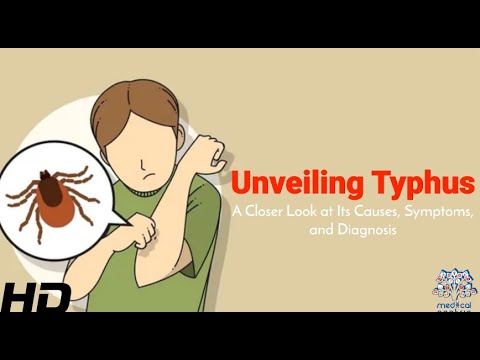Typhus Deep Dive: How It Spreads and Who’s at Risk [Video]