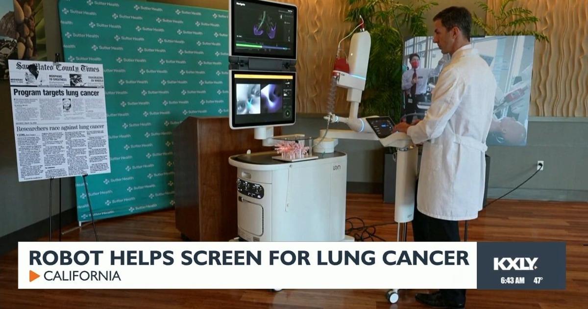 Robot helps screen for lung cancer | Video