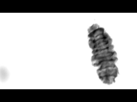 Just add water  – the water bear (tardigrade) [Video]