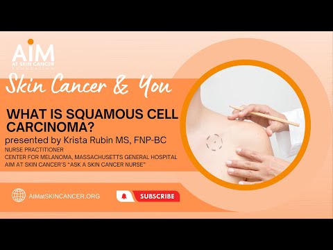 What is Squamous Cell Carcinoma? [Video]