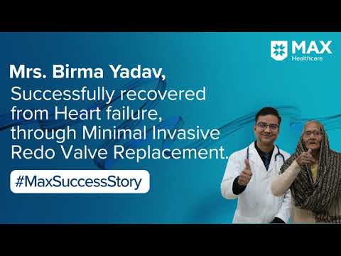 Redo Valve Replacement Surgery for Heart Failure │Patient Success Story │Max Smart Hospital, Saket [Video]