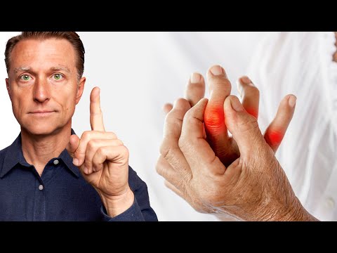 #1 Missing Trace Mineral in ARTHRITIS [Video]