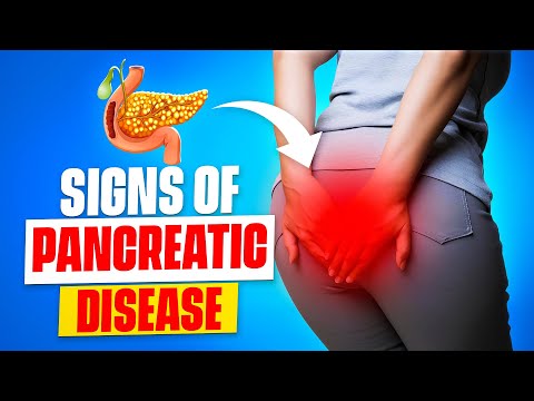 8 WARNING Signs of Pancreatic CANCER You Should NEVER Ignore. [Video]