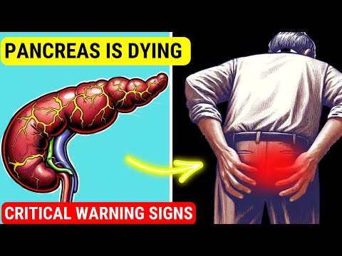 ATTENTION - 10 Symptoms of PANCREATIC CANCER - Do Not Ignore These Critical Warning Signs [Video]