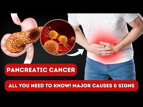 Pancreatic cancer symptoms ,risk factors and prevention [Video]