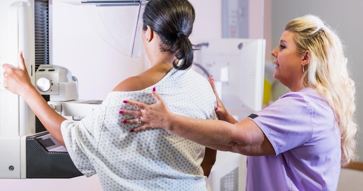 More women are falling behind on breast cancer screenings, study shows [Video]