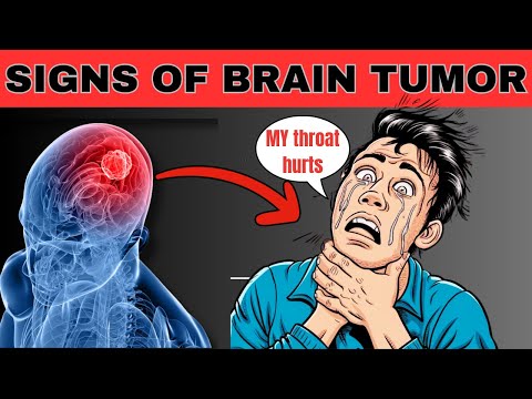10 Early Warning Signs of Brain Tumor| 10 Signs You Should Never Ignore [Video]