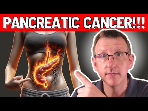 10 TOP early warning signs of PANCREATIC CANCER (ACT NOW!) [Video]