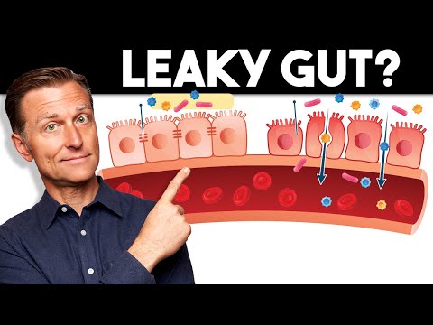 7 Signs of a Leaky Gut — Dr. Berg [Video]