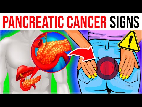 10 Crucial Warning Signs Of Pancreatic Cancer You Must NEVER Ignore [Video]