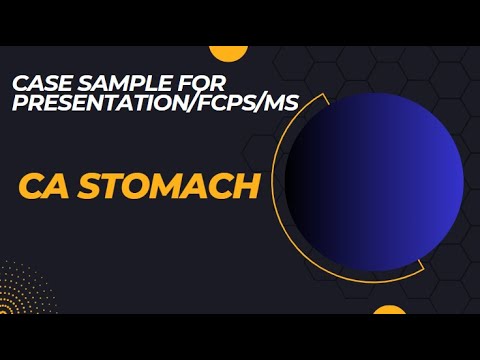 Case Sample - For presentation / Exam(FCPS,MS)  - Carcinoma Stomach [Video]