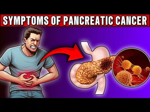 10 Symptoms of Pancreatic Cancer That Could Save Your Life! [Video]