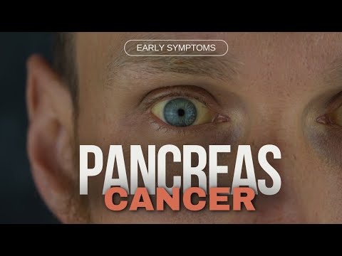 Early Warning Signs and Homeopathy for Pancreatic Cancer [Video]