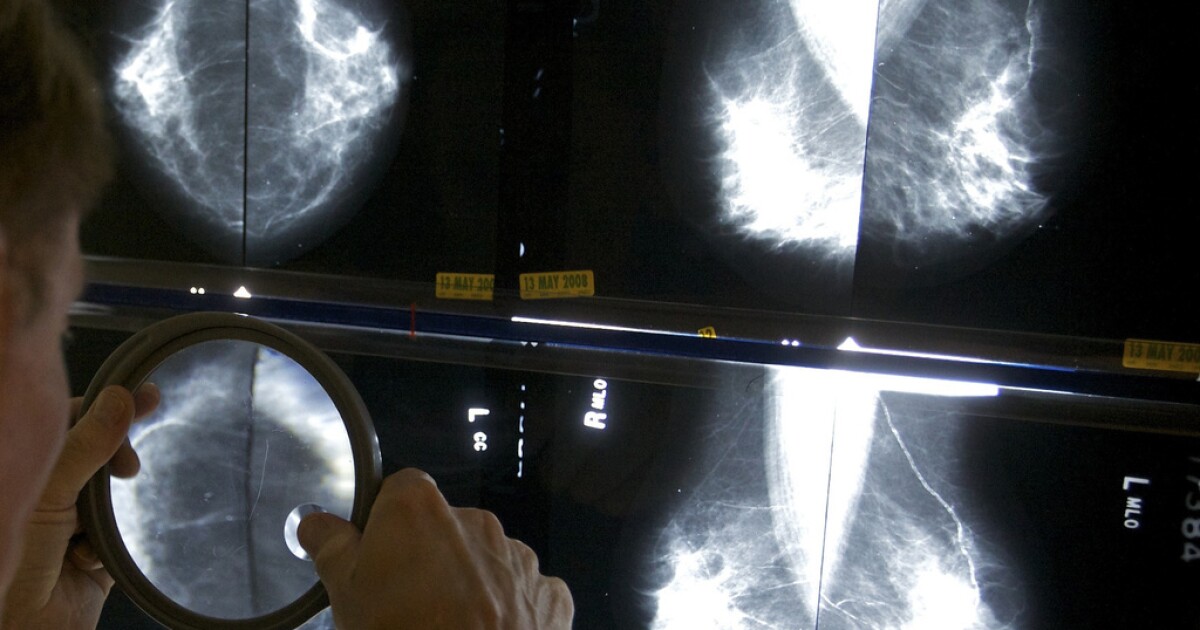 Women should start getting regular mammograms at age 40, US panel says [Video]