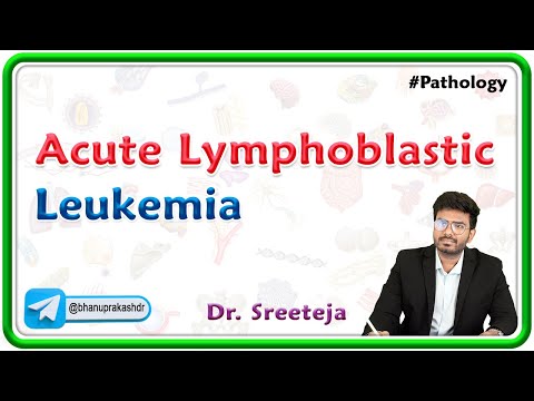15. Acute Lymphoblastic Leukemia (ALL) | USMLE Step 1 Pathology [Video]