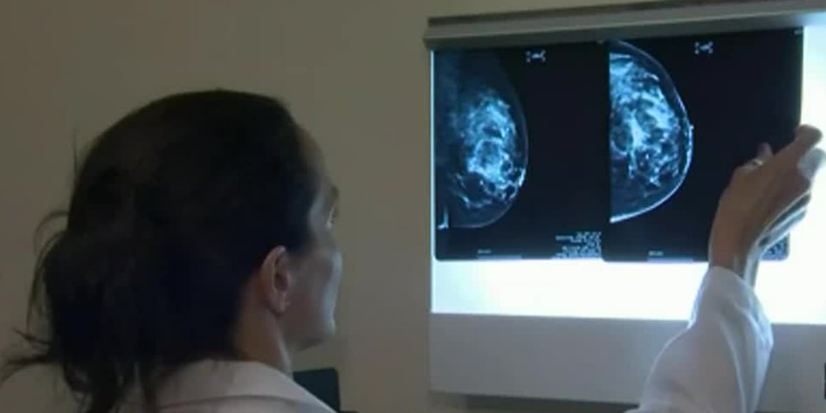 Panel recommends starting breast cancer screenings for women at age 40 [Video]