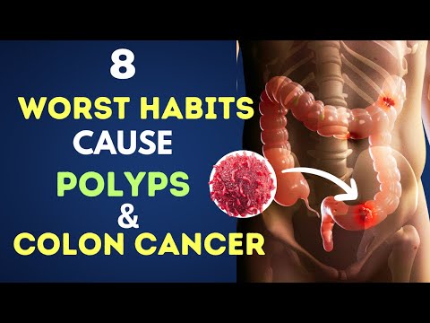 8 Worst Daily Habits to Cause Polyps and Colon Cancer | Colon Cancer Prevention [Video]