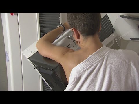 Mammograms now recommended at 40: Colorado doctor reacts [Video]