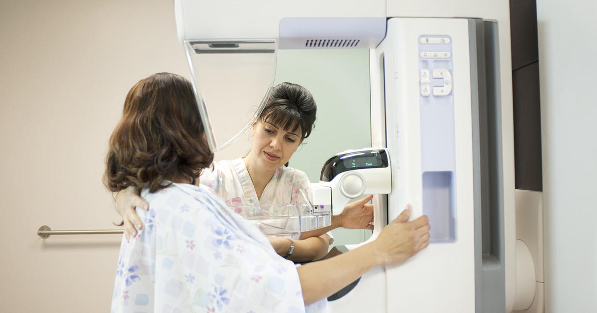What to know about new breast cancer screening guidelines [Video]